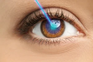 Vision After retinal Surgery eye