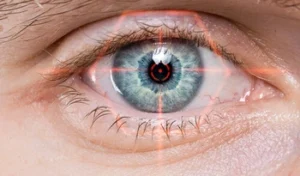 Can You Fly After Laser Eye Surgery vision
