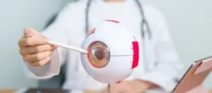 Laser Eye Surgery Korea explanation